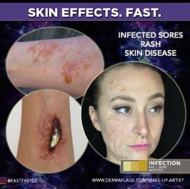 Special Effects Makeup Kit - Infection